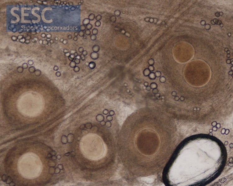 Direct microscopic observation of connective tissue of an animal with besnoitiasis. The spherical structures are the cysts.