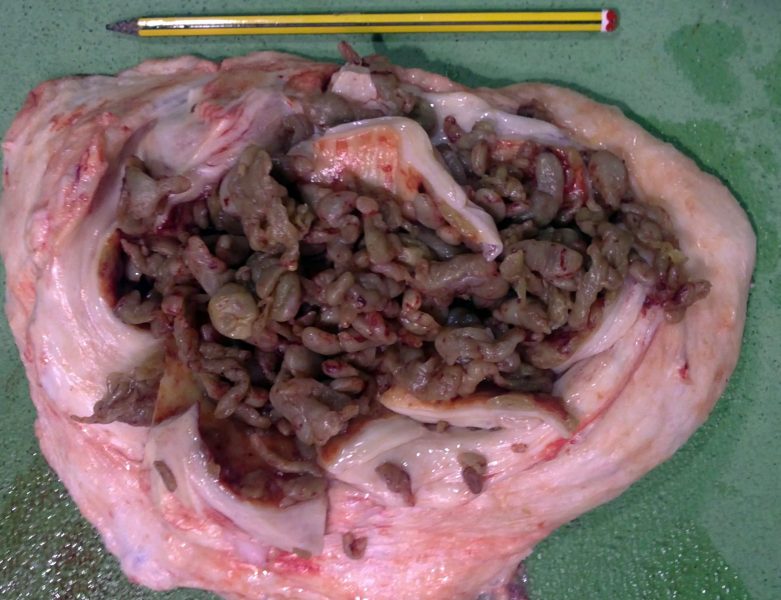Image of the cyst content once opened.