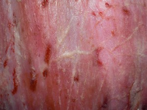 Detail of the altered texture of the subcutaneous adipous tissue. Note the presence of minuscule whitish nodules of gritty appearance, which correspond to the Besnoitia bradyzoites cysts, big enough to be seen with the naked eye.