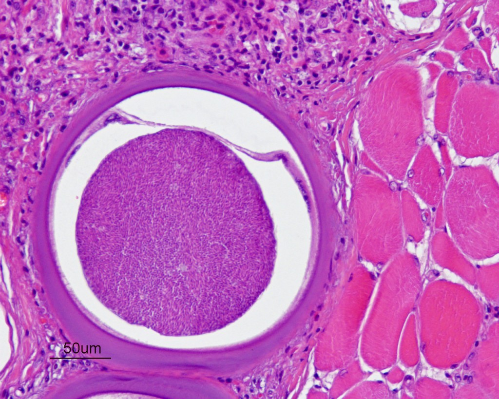 Microfotografía con tinción de Hematoxilina Eosina. Uno de los múltiples quistes observados (centro), de tamaño bastante grande, que contienen multitud de bradizoitos de Besnoitia entre las fibras musculares (a la derecha) y asociados a reacción inflamatoria (arriba a la izquierda).