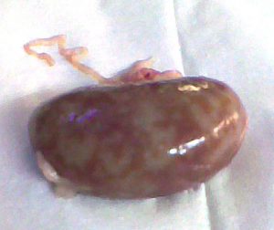 White spots in the kidney surface.