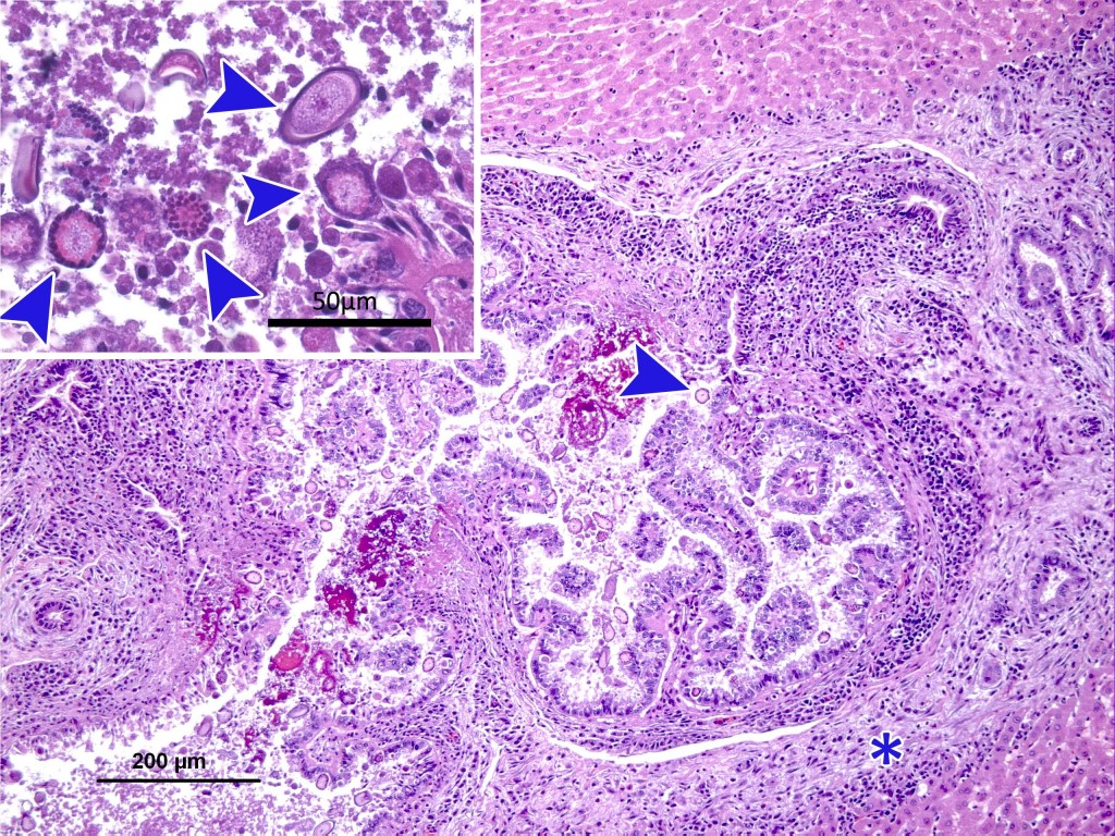 Microfotografia amb tinció d’Hematoxil•lina Eosina. Es pot observar hiperplàsia dels conductes biliars, inflamació i fibrosi periductal (asterisc) així com la presència d’estructures protozoaries a l’interior dels conductes i a l’epiteli (sagetes). Ampliat a dalt a l’esquerra.