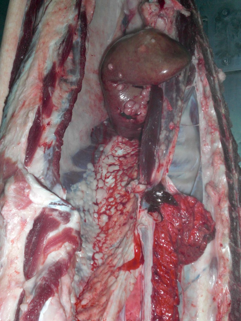 Lesiones nodulares en el riñón y el peritoneo.