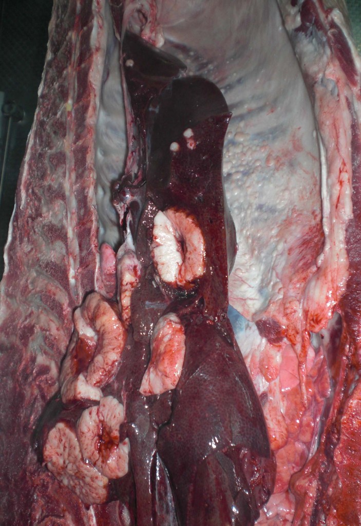 Lesions nodulars blanquinoses de gran mida al parènquima hepàtic, es poden observar lesions de mida mes reduïda a la paret de la cavitat abdominal.