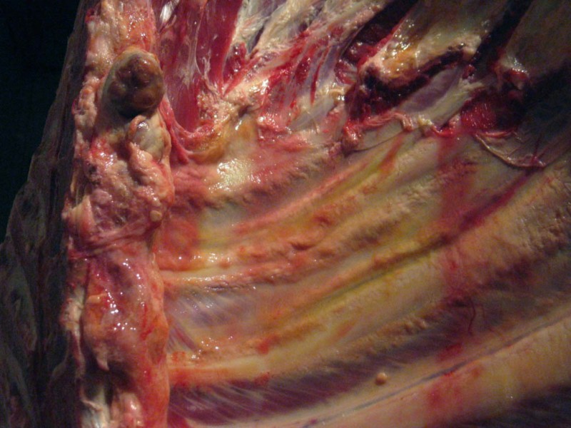 Detail of the lesion in the parietal pleura.