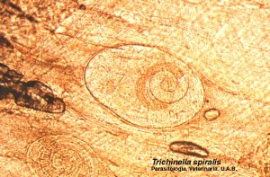 Quistes de Trichinella spiralis. Triquinoscopio.