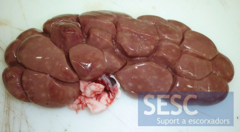 Kidney with whitish spots of miliary distribution.