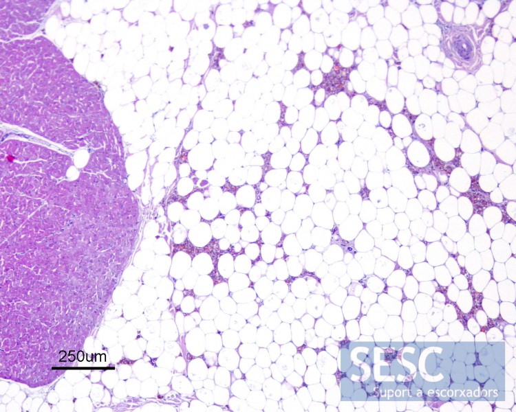 Pigment deposits could be observed between normal cells of the adipose tissue.