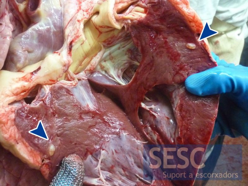 Les dues meitats del nòdul (sagetes), situat a la paret del ventricle esquerre, fan prominència un cop tallat.