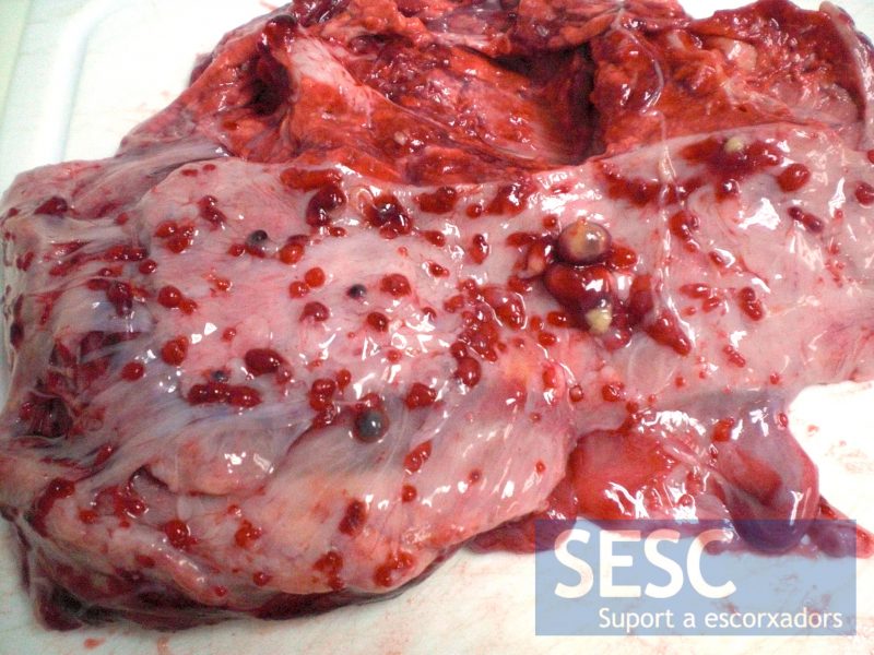 Múltiples lesiones multifocales miliares en la pleura visceral.