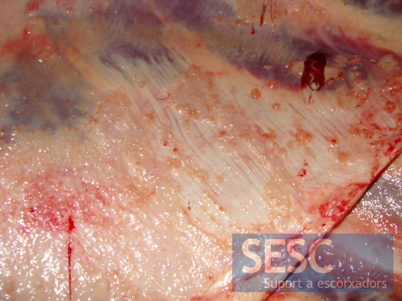 Lesion detail on the peritoneum.