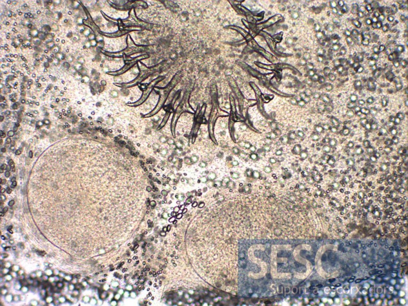Figura 2: Observació de l'escòlex de C.tenuicollis a 100 augments, es poden observar dues de les 4 ventoses i la doble corona de ganxos.