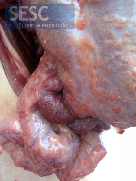 Case 1, detail of the inflammatory exudate.
