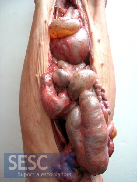 Case 1, deposition of fibrous material on the abdominal serosal surfaces.