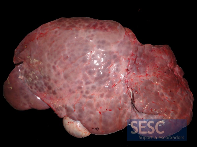 Vista de la cara diafragmática del hígado.