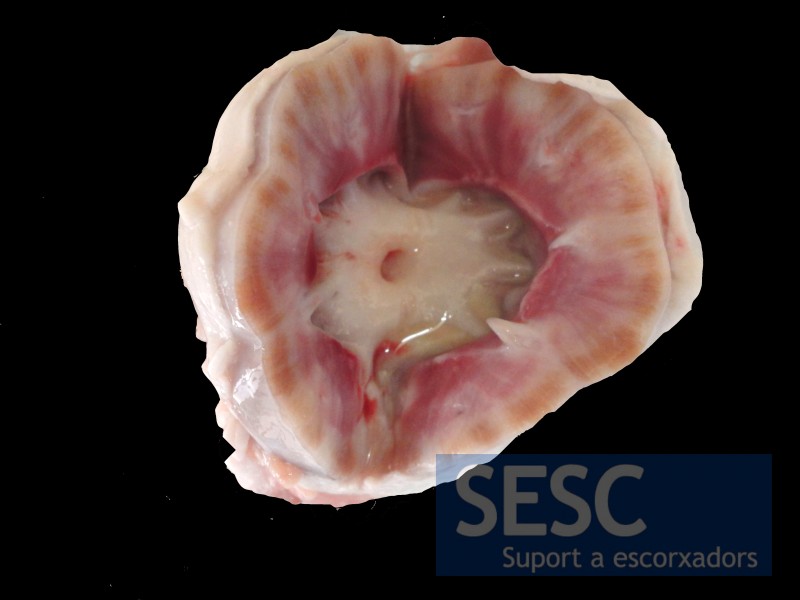 L’altre ronyó presentava lesions molt similars. Es poden observar restes de secreció purulenta a la pelvis renal.