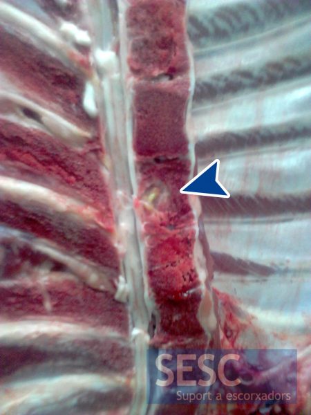 Suppurative lesion in the vertebral body. Microbiological culture was performed from 5 samples submitted to SESC, and in all cases Trueperella pyogenes was isolated. Samples were taken with a cotton swab directly from the lesion.
