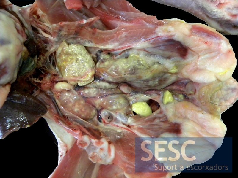 Enlarged, pale kidneys with yellow deposits.
