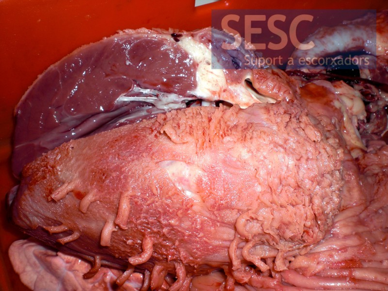 Pericarditis fibrinosa crònica. Hipertròfia de la paret del ventricle.