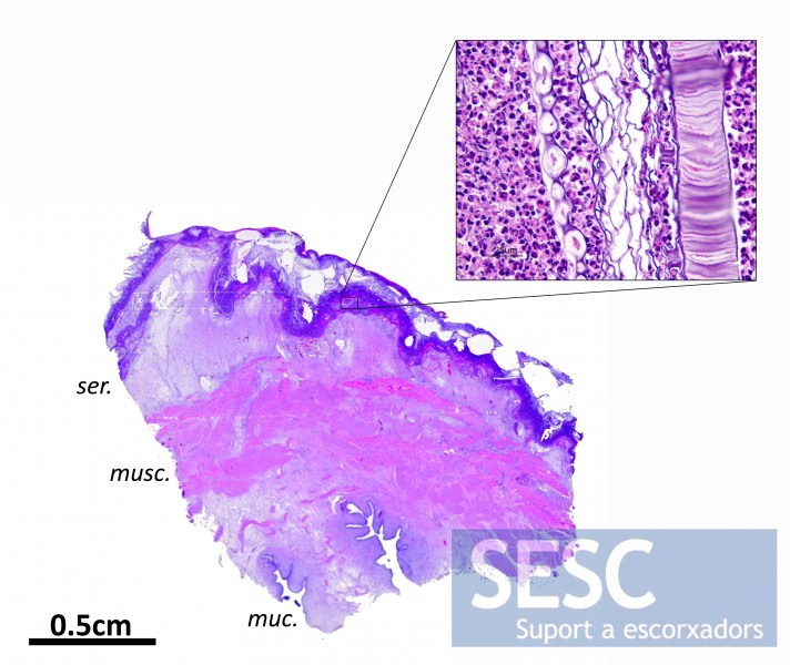 Microfotografia que evidencia restes de material vegetal entre l’infiltrat de cèl•lules inflamatòries localitzat a la serosa de la bufeta (muc: mucosa, ser: serosa, musc: muscular).