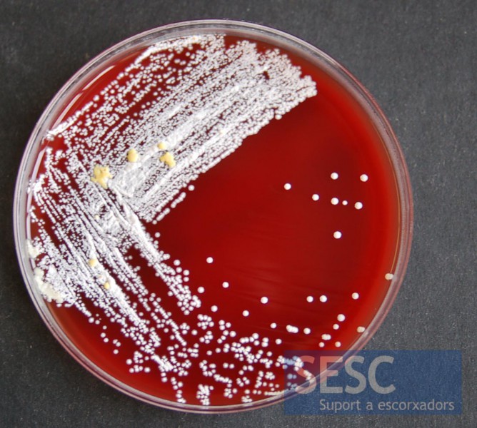 Growth of Nocardia sp. colonies in blood agar from the lung sample.