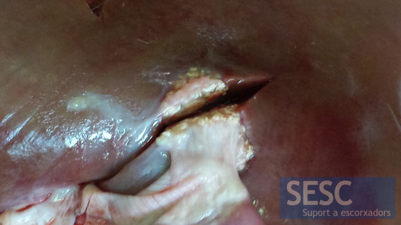 Caso 1: lesión granulomatosa en el hígado de un cordero de 3 meses.