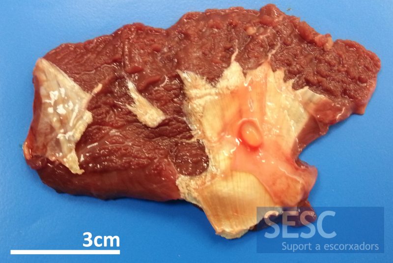 Lesión vesicular en la fascia del masetero interno.