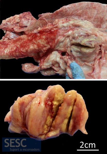 CAS 1: Lesió granulomatosa en el nòdul limfàtic traqueobronquial d'un vedell mascle de raça creuada de 13 mesos. A la imatge de sota es pot apreciar la lesió un cop tallat el nòdul limfàtic.