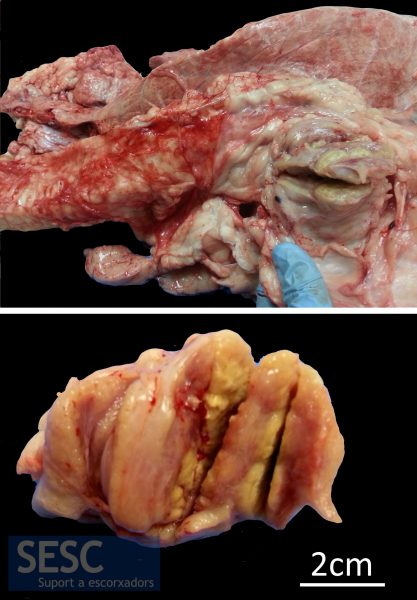 CASO 1: Lesión granulomatosa en el nódulo linfático traqueobronquial de un ternero macho de raza cruzada de 13 meses. En la imagen de abajo se puede apreciar la lesión una vez cortado el nódulo linfático.