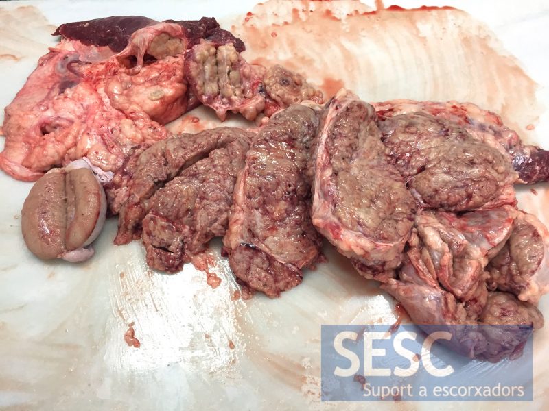 Normal sized testis, on the left, next to the mass extracted from the pelvic cavity.