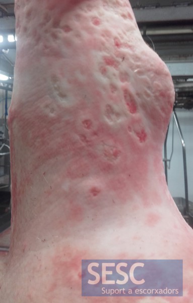 Cas 2: les lesions crateriformes també afecten la pell de les extremitats.