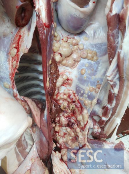 Múltiples nòduls a la paret de la cavitat abdominal i al diafragma.