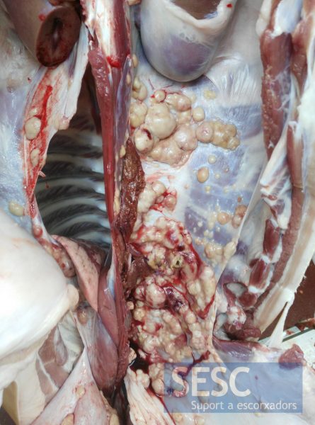 Múltiples nódulos en la pared de la cavidad abdominal y el diafragma.
