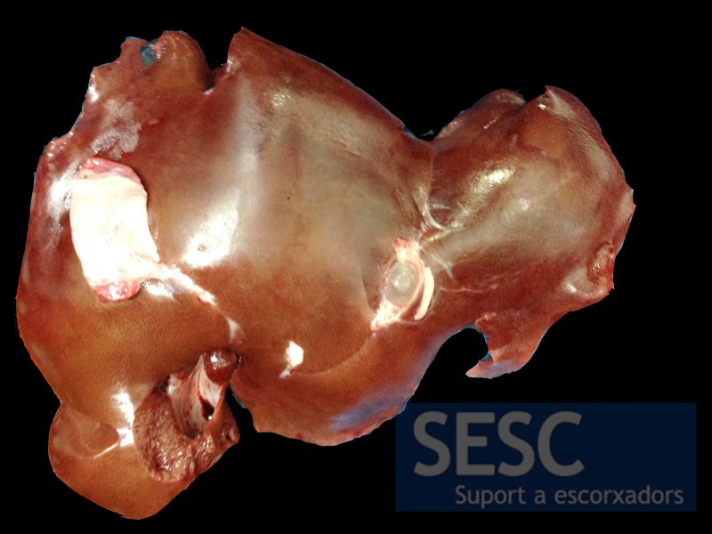 Hígado de cerdo con una vesícula transparente adherida a la serosa.