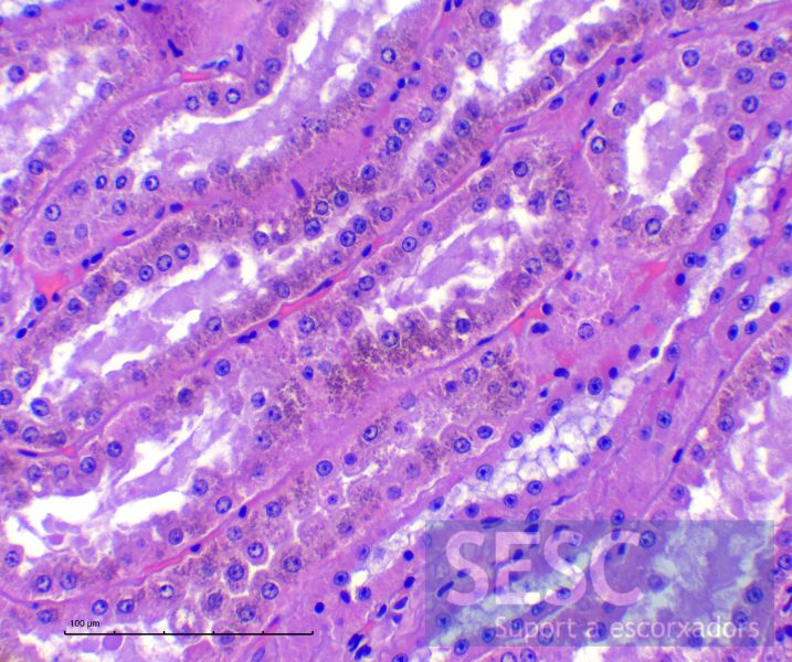 Histologia (hematoxilina-eosina) del ronyó. S’observen dipòsits de pigment granular refringent ocraci al citoplasma dels túbuls proximals. 