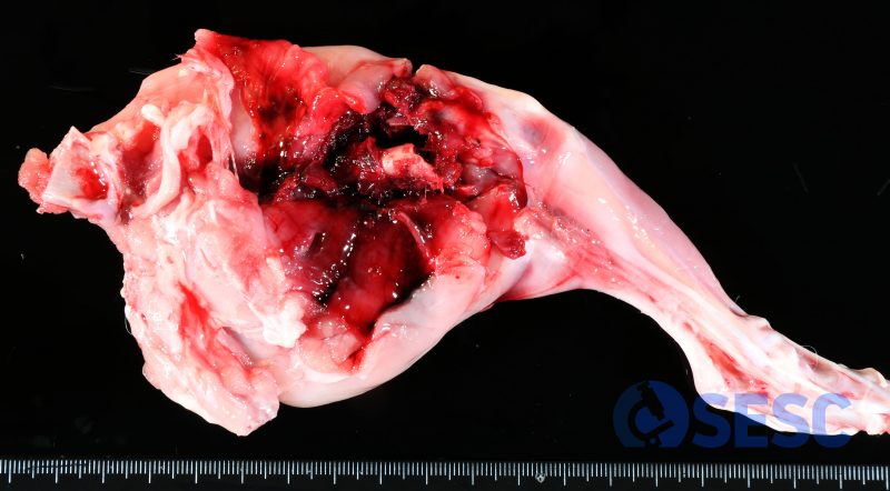 Al dissecar l’extremitat, s’evidencia una fractura del fèmur, que ha provocat l’extensa hemorràgia. 