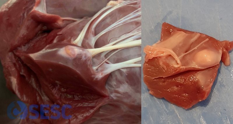 Exemples de cisticercs subendocàrdics rebuts al SESC. Tot i localitzar-se a prop de les cordes tendinoses, sempre involucren el múscul cardíac en major o menor mesura, per tant no es poden trobar a la cara lliure de les vàlvules atrioventriculars. 