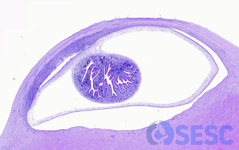 Secció histològica del cisticerc observat anteriorment (a l'esquerra de l'anterior imatge). Es pot observar com es localitza subjacent al endocardi, però en contacte amb el teixit muscular. Es pot observar la membrana parasitaria, així com el protoscòlex invaginat.
