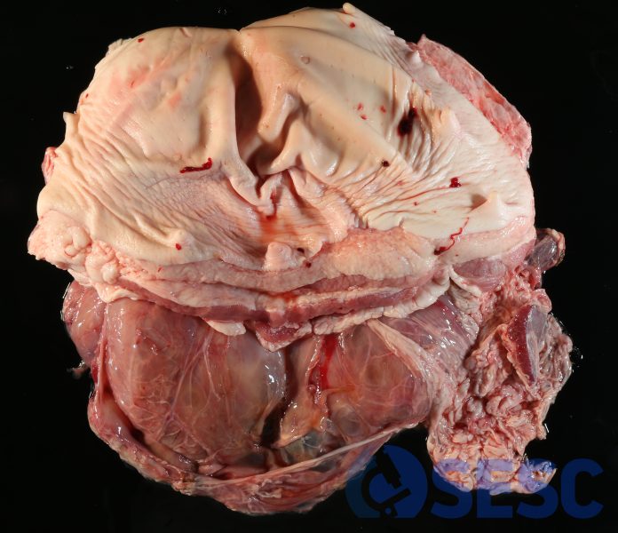 Pell i paret abdominal. Una de les vísceres decomissades consisteix en paret abdominal (incloent pell, musculatura abdominal i superfície peritoneal parietal). Es trobava adherida amb una porció de melsa per la cara interna. Presenta una gran tumefacció localitzada, que a la palpació fluctua. 