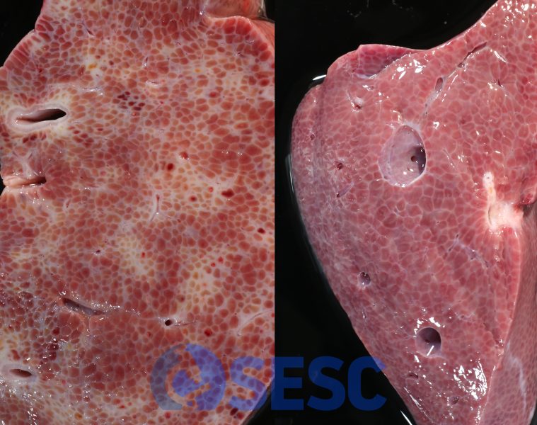 Detall de la secció de dos fetges: sa (dreta) i afectat (esquerre). Al fetge sa s’observen els lòbuls hepàtics molt finament delimitats per teixit conjuntiu. En canvi, al fetge afectat s’observen àrees multifocals irregulars de dipòsit de teixit fibrós, que envolten i comprimeixen els lòbuls adjacents (hepatitis intersticial). 