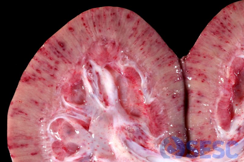 A la secció es podien observar que els focus a la superfície de l’escorça es corresponien amb àrees envermellides amb distribució radial a l’escorça. També es poden observar petèquies a la pelvis renal. 