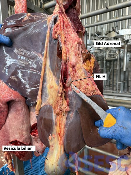 Fetge de boví penjat per a inspecció: es mostra la cara visceral, el ganivet assenyala el NL H. Cal anar amb compte i no confondre’l amb la glàndula adrenal (Gld Adrenal) que pot quedar adherida al fetge en extreure’l de la cavitat abdominal.