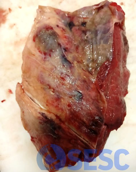 Una altra secció de múscul afectat. En aquest cas s’observen zones endurides i blanquinoses degut a l’extensa fibrosi. 