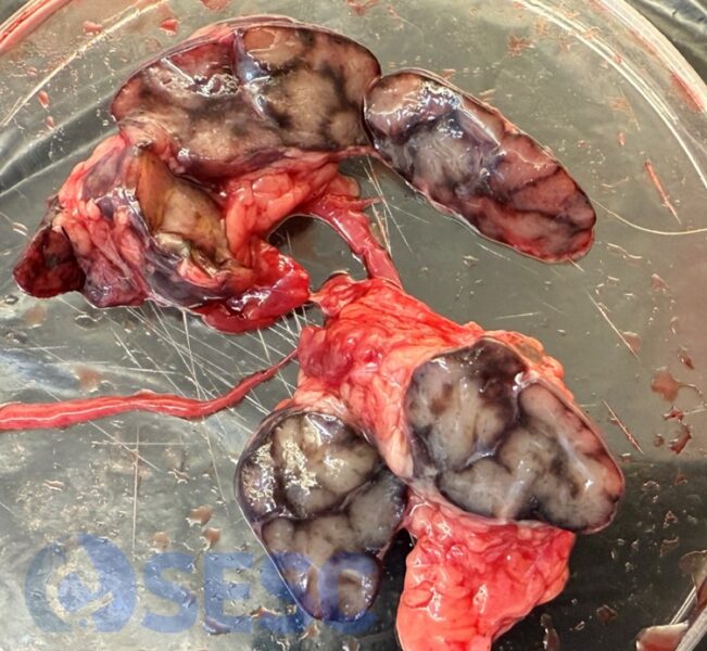 Exemple de nòdul limfàtic de senglar sa, sense PPA, capturat per un caçador on es pot observar reabsorció de sang als sinus subcapsulars i trabeculars, per probable reabsorció de sang de les hemorràgies produïdes per el tret. No confondre amb hemorràgies del propi teixit limfoide. Amb el pas del temps, l'autòlisi i també en teixits congelats l'hemoglobina pot difondre i el teixit pot presentar un color mes envermellit.