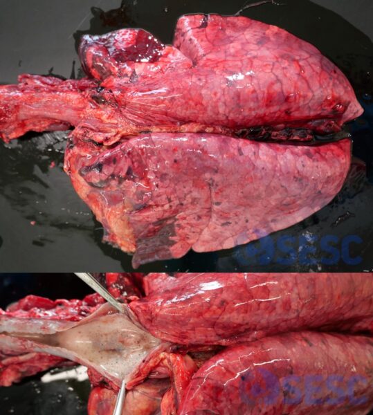 Una altre imatge de pulmons sense col·lapsar un cop extrets de la cavitat toràcica, amb hemorràgies i amb distensió dels septes interlobel·lars (edema intersticial). En obrir la tràquea (meitat inferior de la imatge), s’observa presència d’escuma a les vies respiratòries (edema alveolar).
