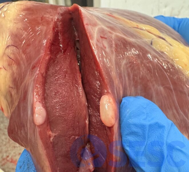 Lesió nodular blanquinosa al miocardi d'una vaca.